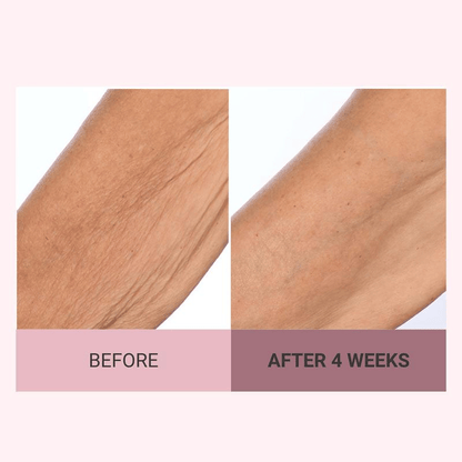 💆‍♀️ Experience Ultimate Luxury - 79% OFF - ✨ Champagne Beaute Lift Firming Body Crème - For Firmer, Smoother, Radiant Skin! 🌟