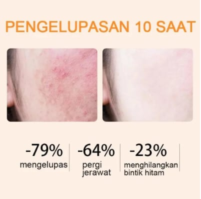 Tiworld®🔥Orange Enzyme Exfoliating Gel — The Gentle Miracle Your Skin Has Been Crying Out For